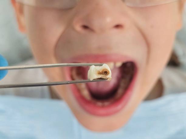 Best Weekend Emergency Dentist in Granite Shoals, TX